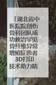 湖北省中医院院创伤骨科团队成功救治罕见骨纤维异常增殖症患者 3D打印技术助力精准矫形手术